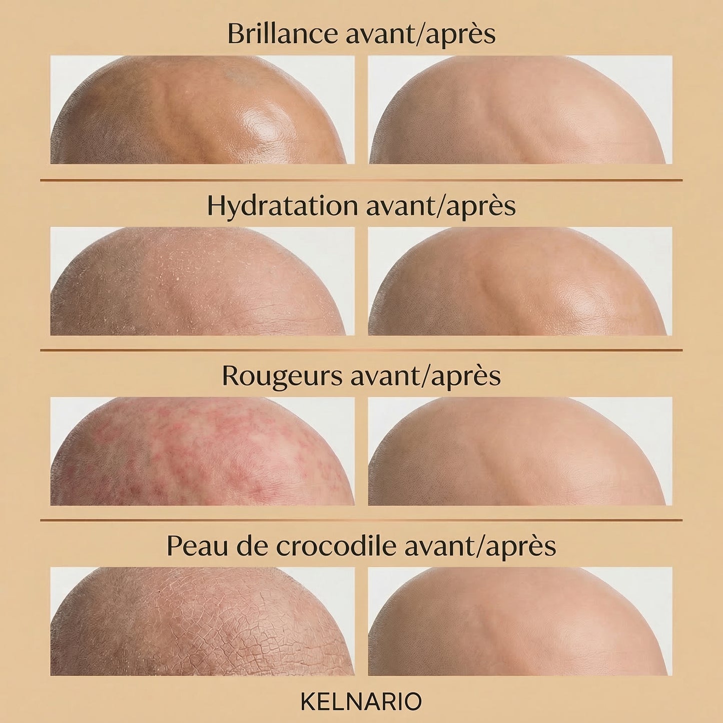 La crème n°1 des crânes rasés