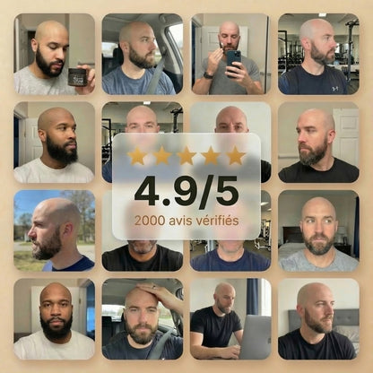La crème n°1 des crânes rasés